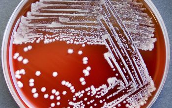 Corynebacterium diphtheriae Blood Agar 48h culture incubated with CO2