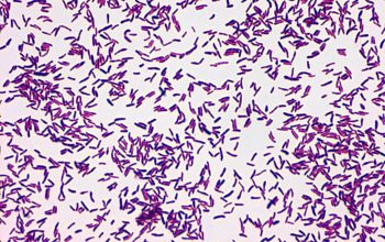 corynebacterium diphtheriae simple stain