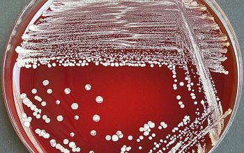 Corynebacterium durum Blood Agar 48h culture incubated with CO2