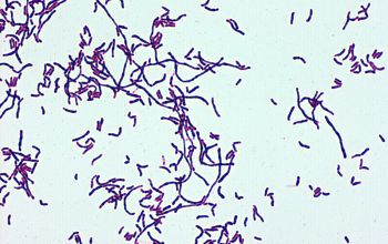corynebacterium gram stain