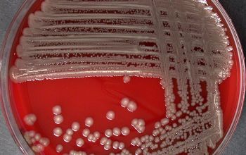Cronobacter sakazakii Blood Agar 24h culture incubated with CO2