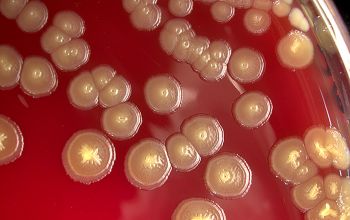 Cronobacter sakazakii Blood Agar 48h culture incubated with O2