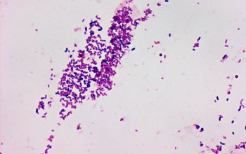 Dermabacter hominis Gram stain