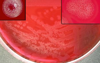 Eikenella corrodens Blood Agar 48h culture incubated with CO2