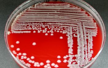 Enterobacter aerogenes Blood Agar 24h culture incubated with O2