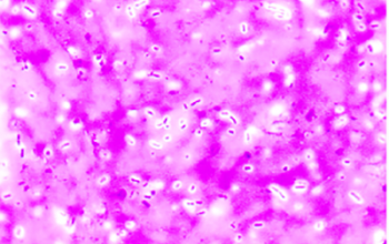 Enterobacter aerogenes Gram stain