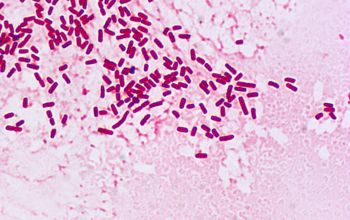 Enterobacter cloacae Gram stain