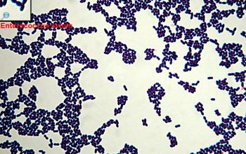 Enterococcus avium Gram stain