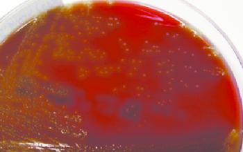 Enterococcus avium Blood Agar 48h culture incubated with CO2