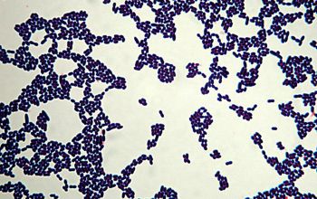 Enterococcus avium Gram stain
