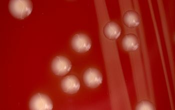 Enterococcus casseliflavus Blood Agar 48h culture incubated with O2
