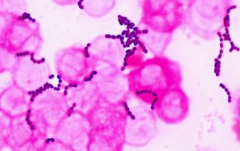Enterococcus faecalis Gram stain