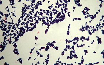 Enterococcus faecalis Gram stain