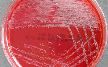 Enterococcus faecalis Mac Conkey Agar without salt 48h culture incubated with O2