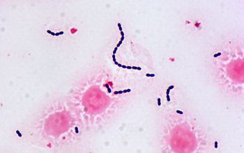 Enterococcus faecium Gram stain