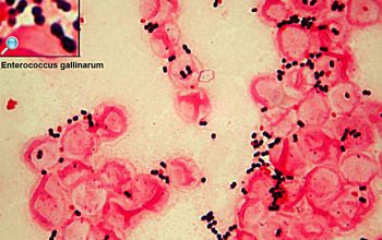 Enterococcus gallinarum Gram stain
