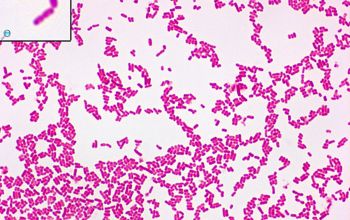 Escherichia coli O157:H7 Gram stain