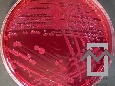 escherichia coli acid fast stain