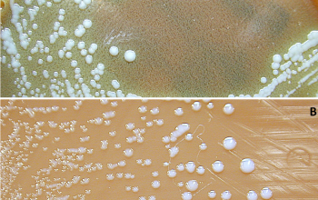Francisella tularensis  culture incubated with CO2