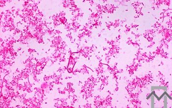 Fusobacterium necrophorum Gram stain