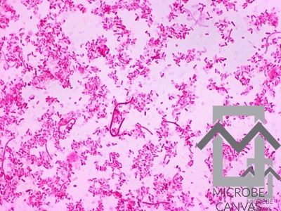 Fusobacterium necrophorum
