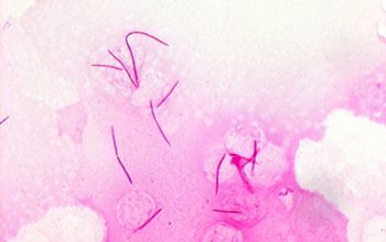 Fusobacterium nucleatum Gram stain