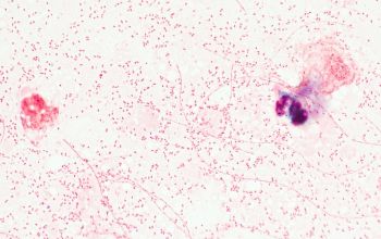 Fusobacterium nucleatum Gram stain