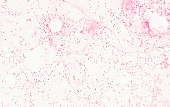 Fusobacterium nucleatum Gram stain