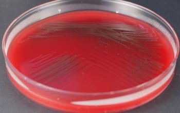 Gardnerella vaginalis Blood Agar 48h culture incubated with CO2