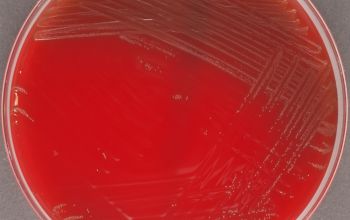 Gardnerella vaginalis Blood Agar 48h culture incubated with CO2