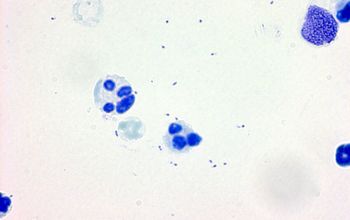 Haemophilus influenzae Methylene blue stain