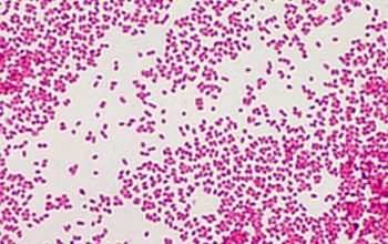 Haemophilus influenzae Gram stain