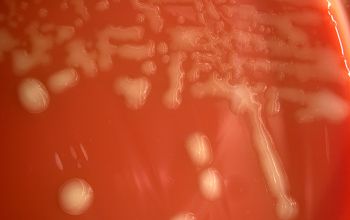 Haemophilus influenzae Blood Agar 48h culture incubated with CO2