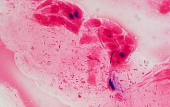Helicobacter pylori Gram stain