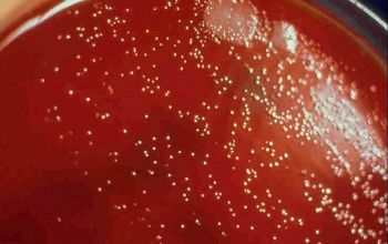 Helicobacter pylori  culture micro-aerophillic