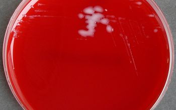 Inquilinus limosus Blood Agar 24h culture incubated with O2