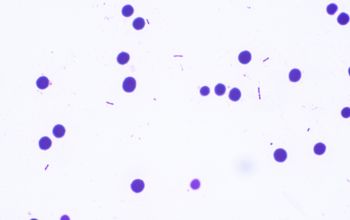 Kingella kingae Gram stain