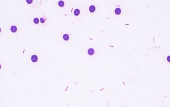 Kingella kingae Gram stain