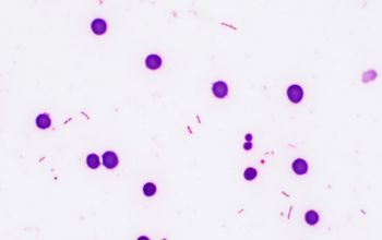 Kingella kingae Gram stain