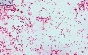 klebsiella pneumoniae gram stain
