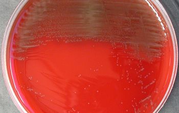 Lactobacillus acidophilus Blood Agar 24h culture incubated with CO2