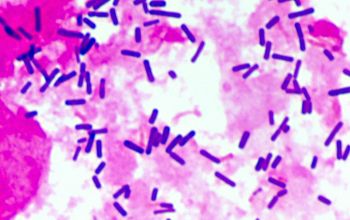 Lactobacillus acidophilus Gram stain