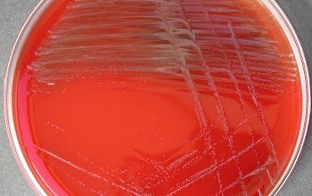 Lactobacillus casei Blood Agar 24h culture incubated with CO2