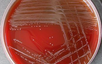 Lactobacillus casei Blood Agar 48h culture incubated with CO2