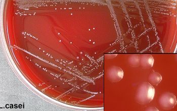 Lactobacillus casei Blood Agar 48h culture incubated with CO2