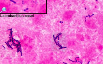 Lactobacillus casei Gram stain