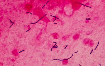 Lactobacillus murinus Gram stain