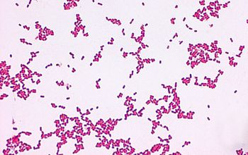 Leclercia adecarboxylata Gram stain