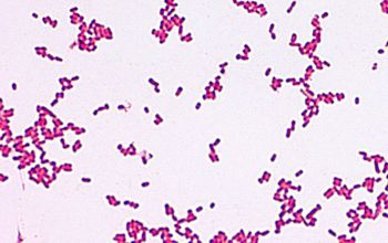 Leclercia adecarboxylata Gram stain