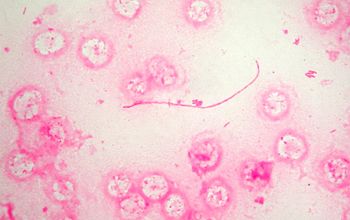 Legionella pneumophila Gram stain